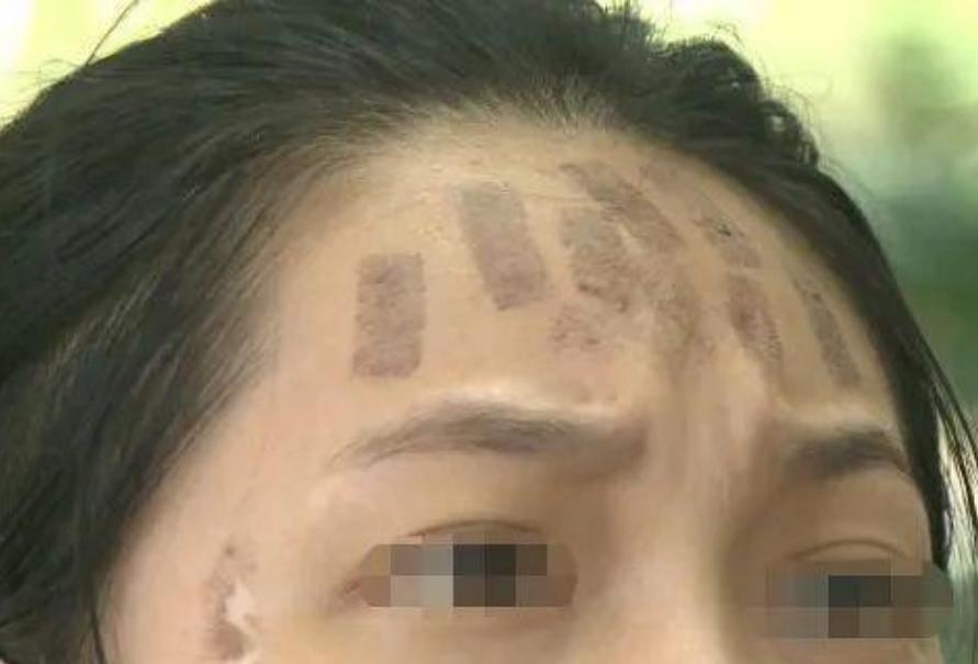 成都光子嫩膚價(jià)格，科技重塑肌膚之美